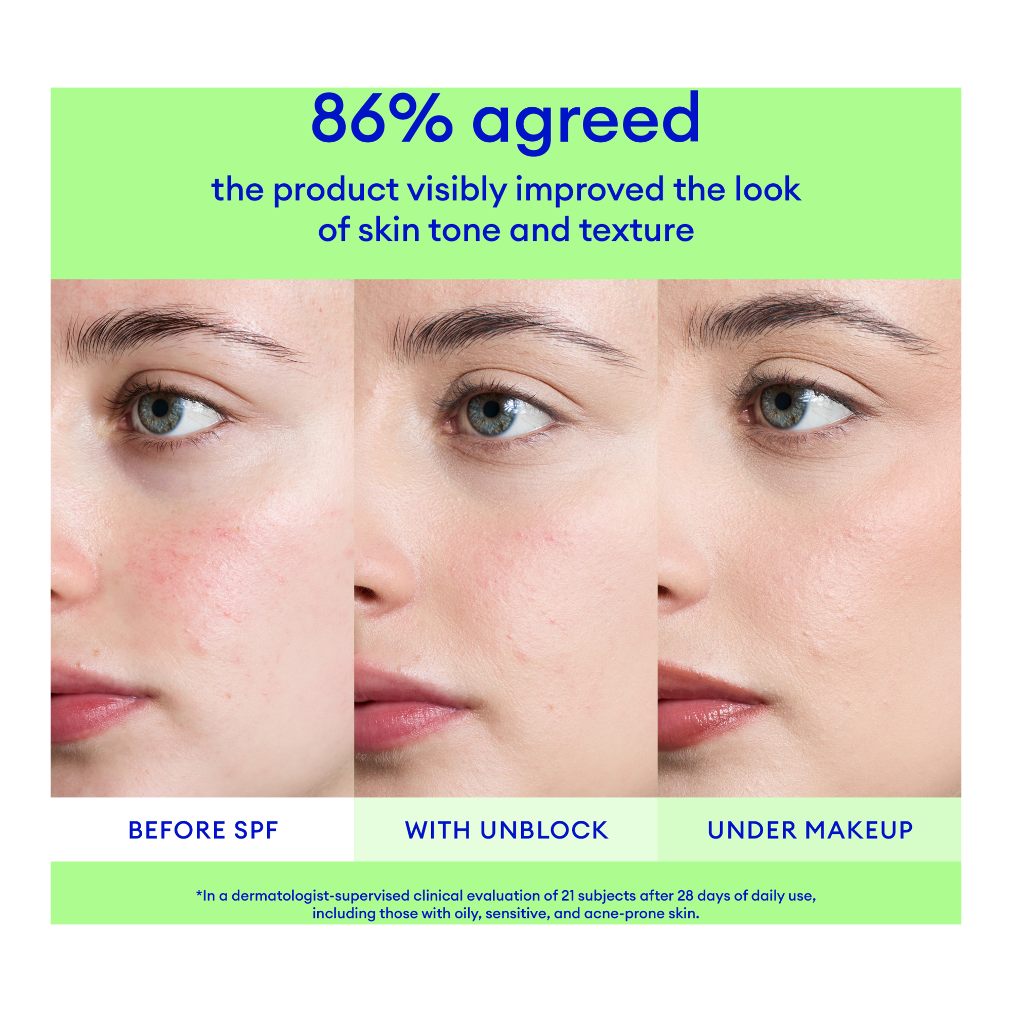 Ultra Violette Unblock Screen SPF 50 Breakout-Friendly SKINSCREEN 50ml