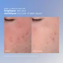Dermalogica Daily Microfoliant